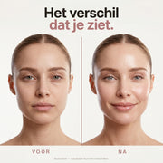 Nura Marine Collageen Shots - Bosvruchtensmaak - 500ml